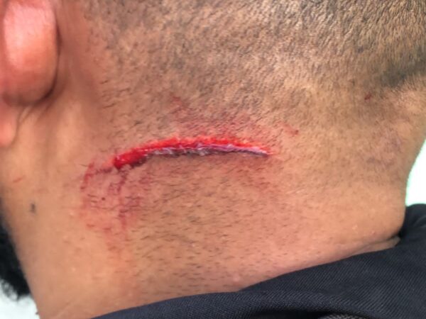 Haitiano hiere miembro de inteligencia de (DGM)