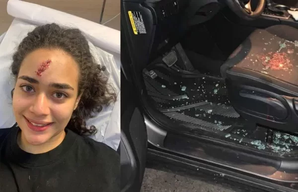 Padre de joven agredida por limpiavidrios dice: "eso se lo dejo a Dios"