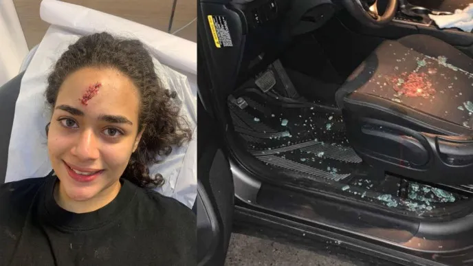 Padre de joven agredida por limpiavidrios dice: "eso se lo dejo a Dios"