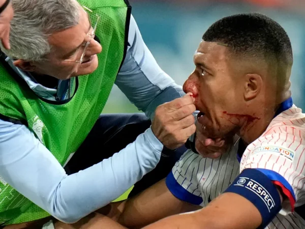 Mbappé no será operado, pero jugará con una máscara